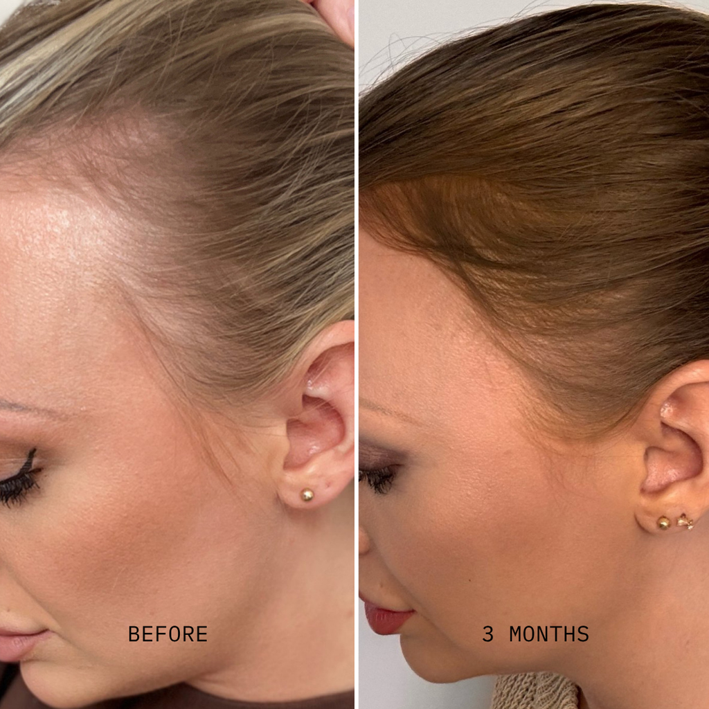 Advanced+ Hair Formula